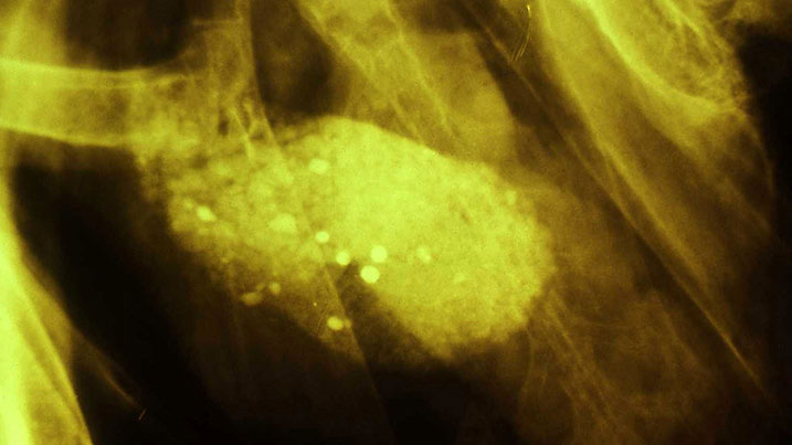 X-ray showing lead pellets in the gizzard of a lead poisoned swan